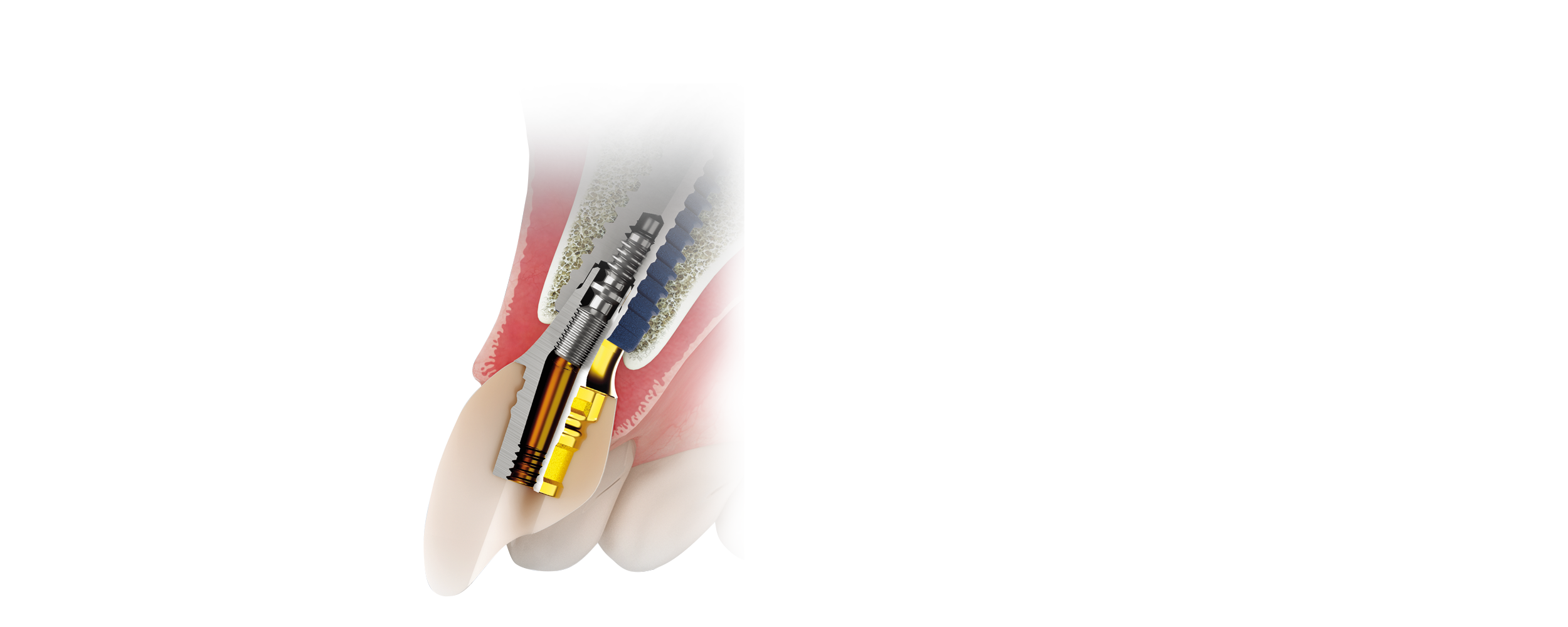 rcbase-product-cover2